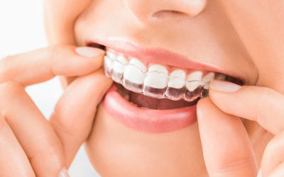 Ortodonzia: cosa c’è da sapere