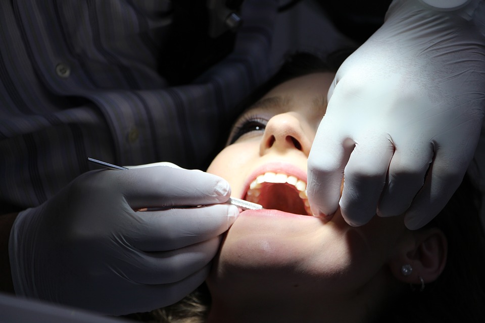 Lo sbiancamento dentale può essere dannoso?